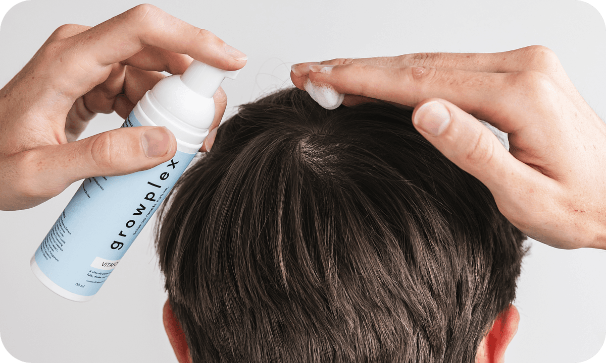 Hair regrowth results