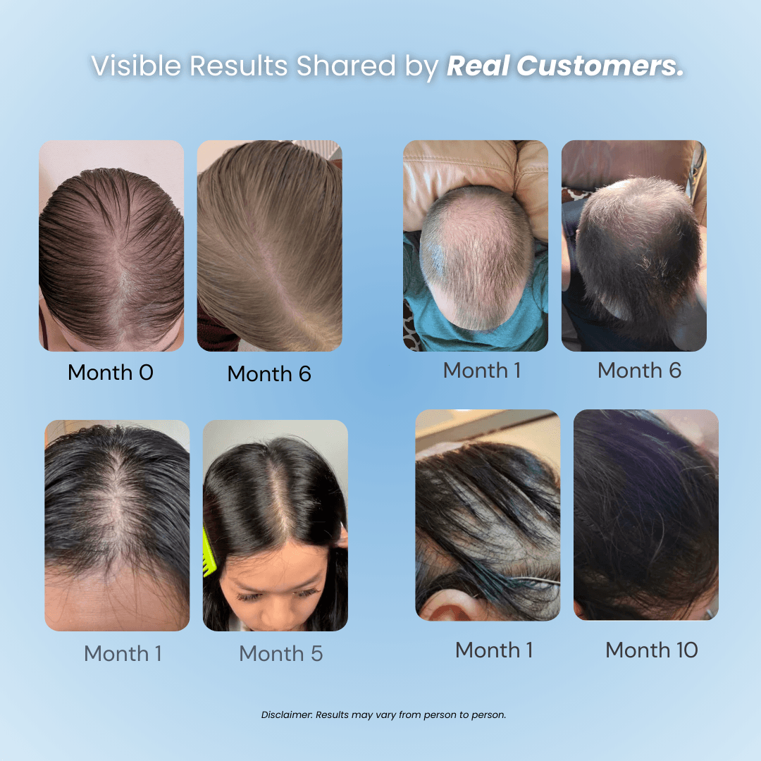 Hair Loss Prevention Kit — photo 3