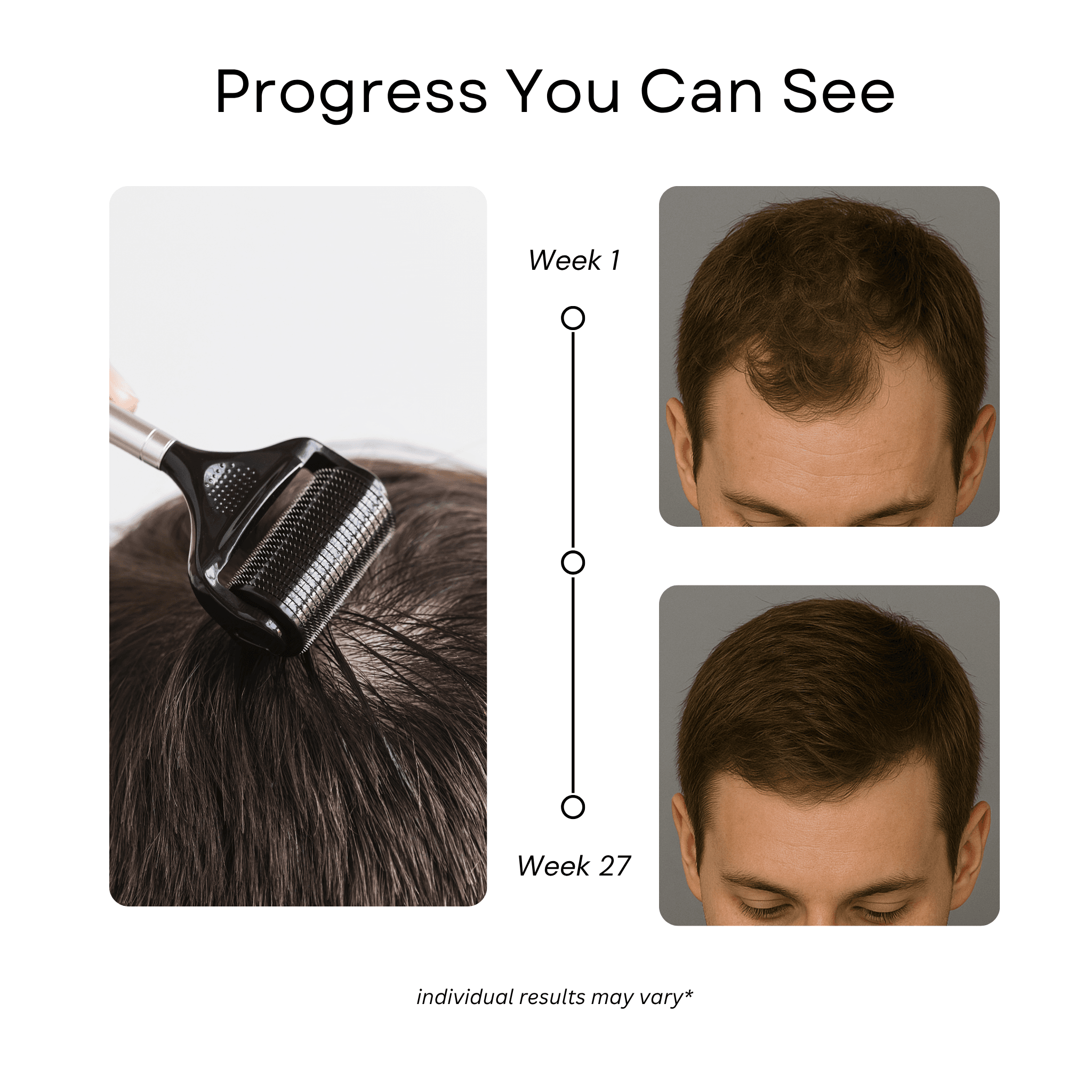 Scalp Roller 2.0 + Sanitizer — photo 4