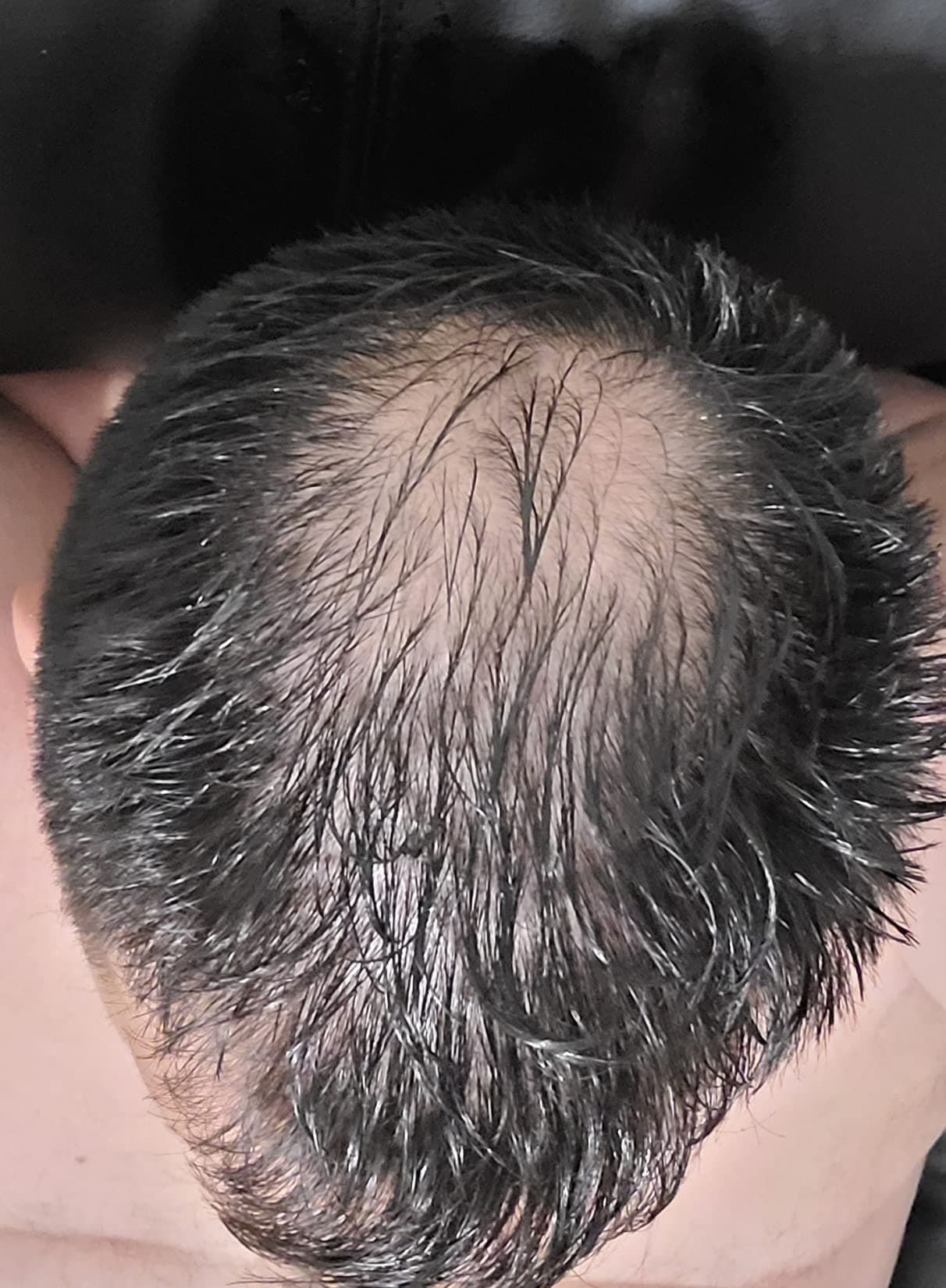 Oliver C. before treatment