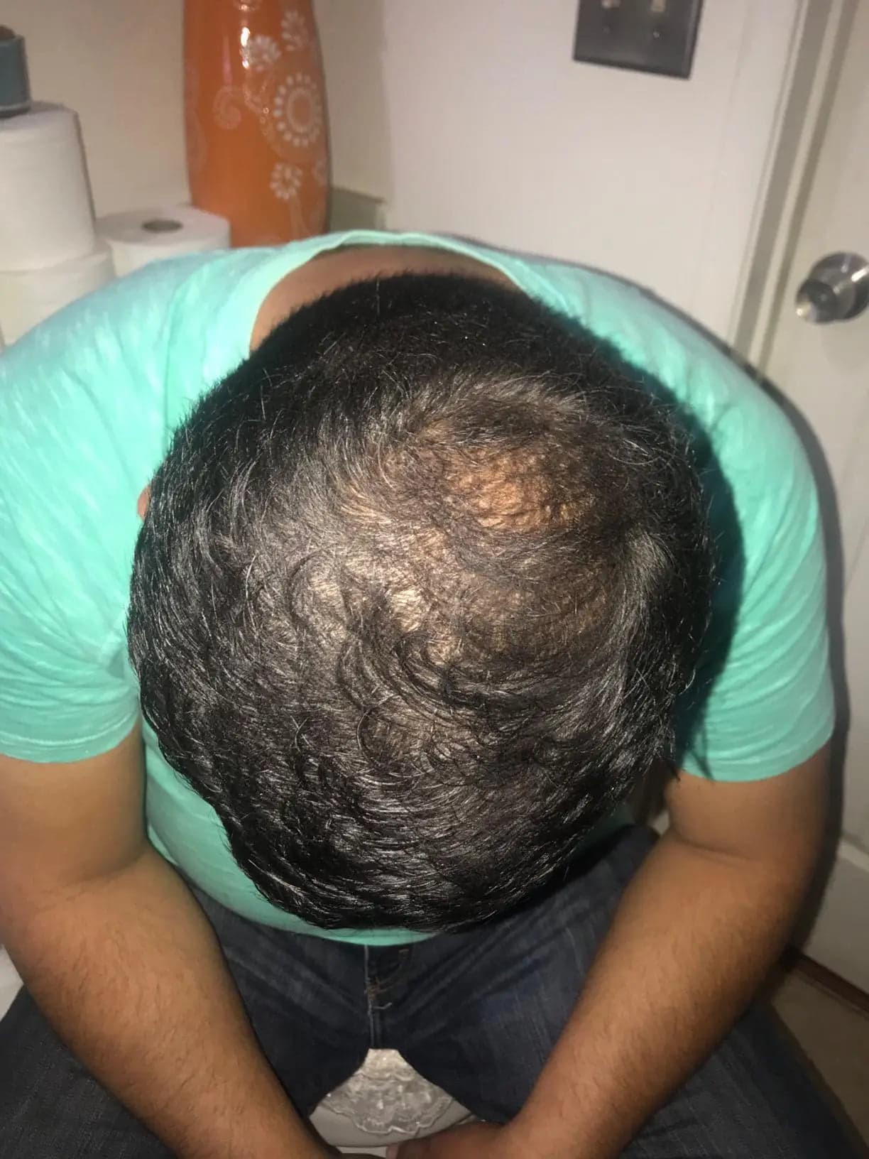 Akshay V. before treatment
