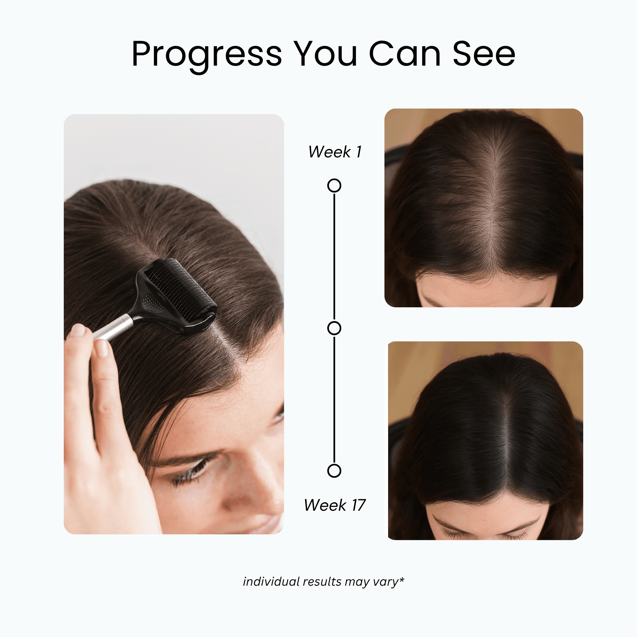 Full Regrowth Kit™ — photo 4