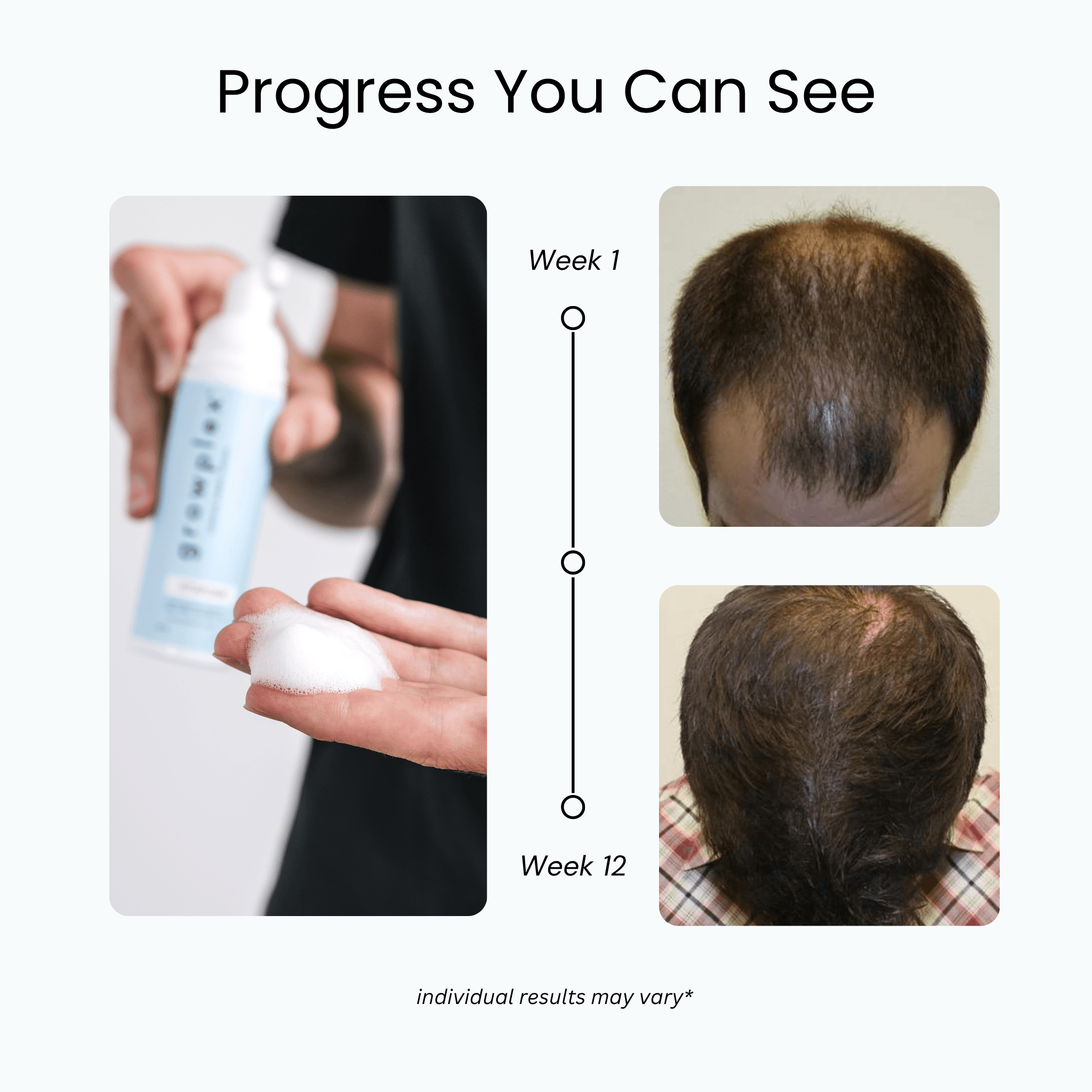 Full Regrowth Kit™ — photo 3