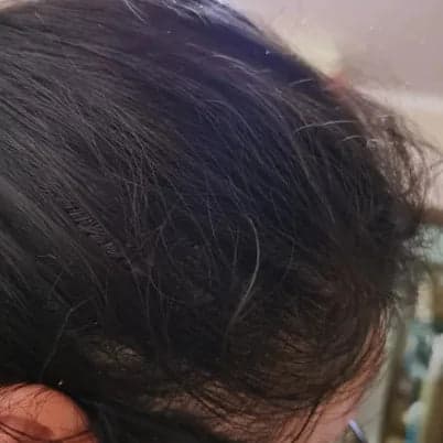 Donna N. after 10 Months