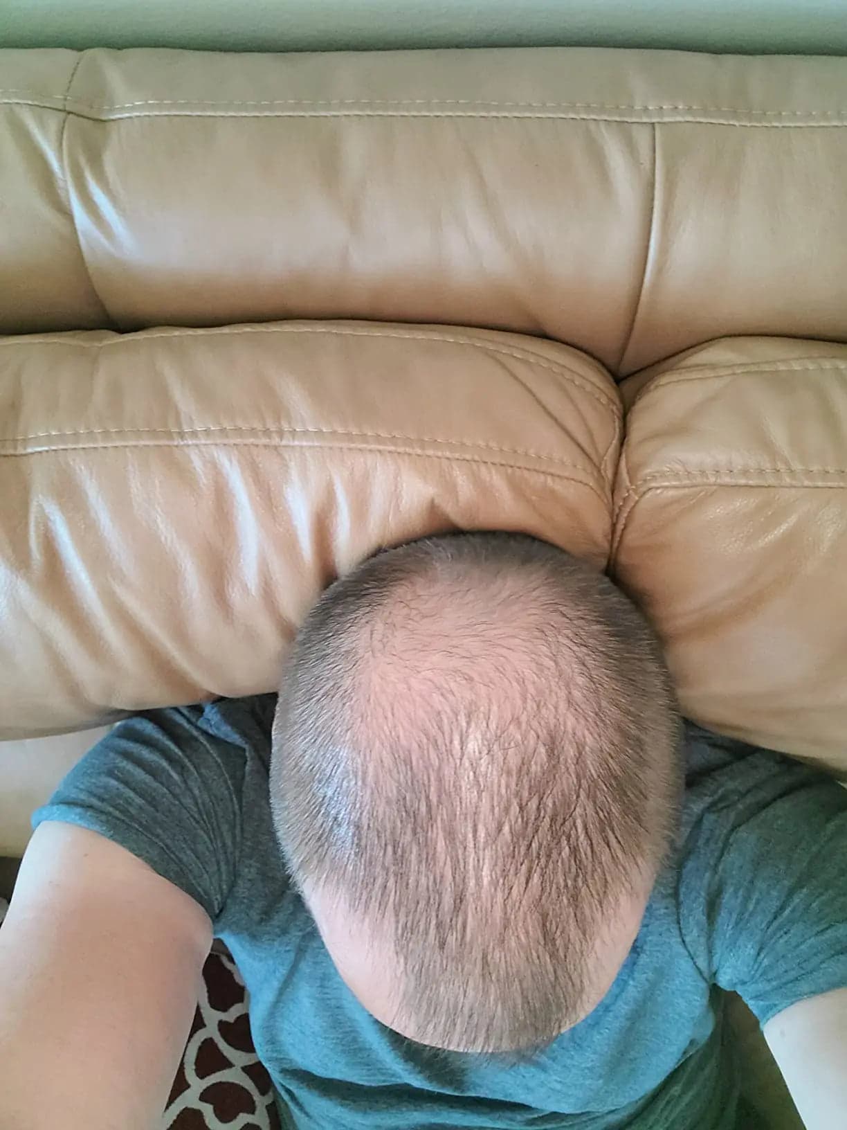 Cole H. before treatment