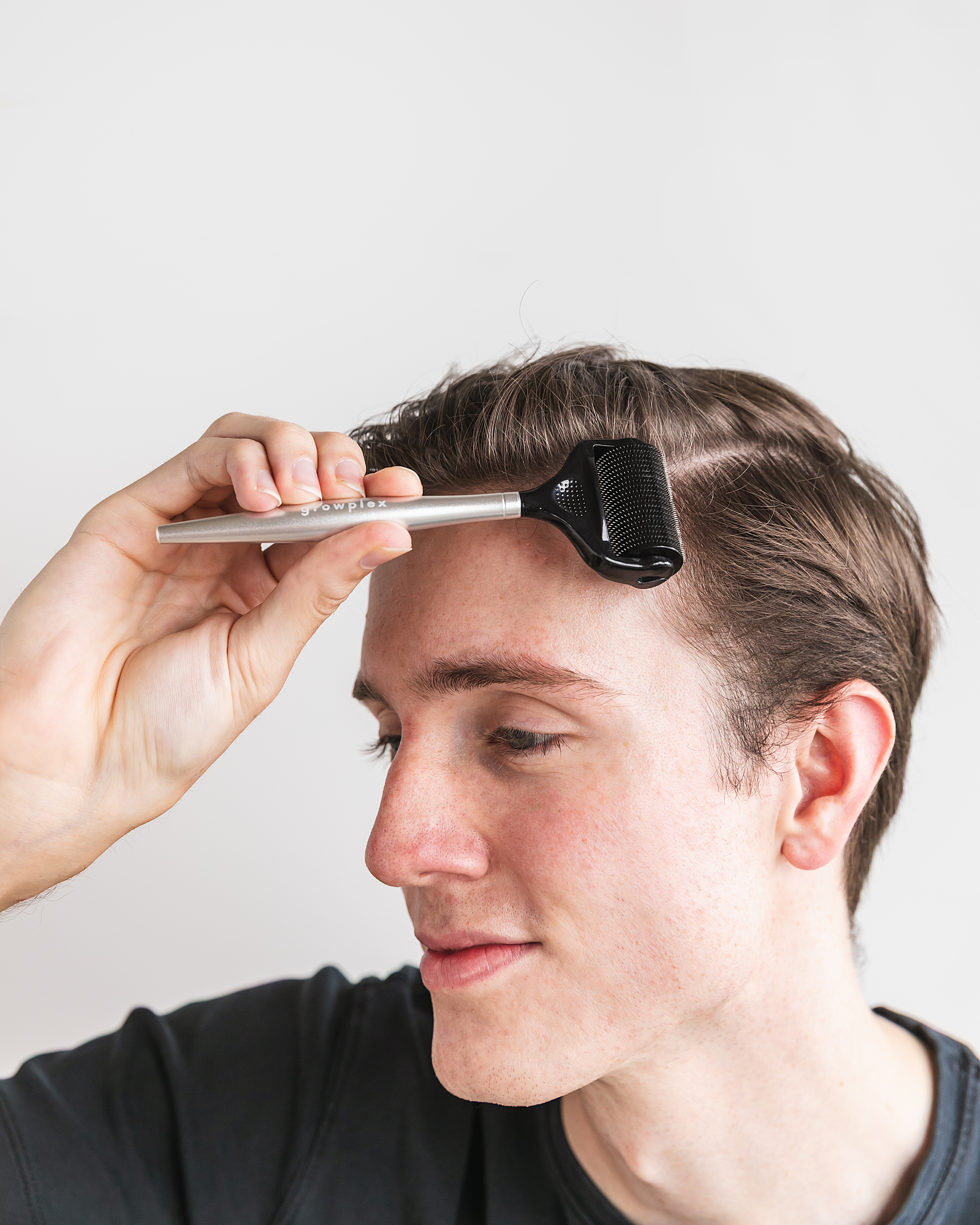 Man applying Growplex hair treatment with derma roller